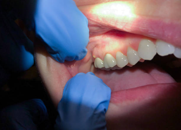 Best Same-Day Emergency Dental Services in Redstone Arsen, AL